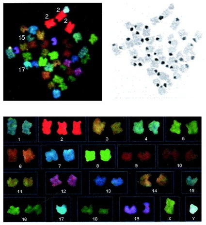 Neurônios que perdem cromossomos