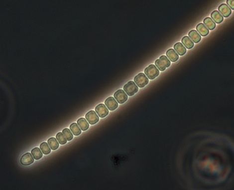 cyanobacteria2_brmma.jpg